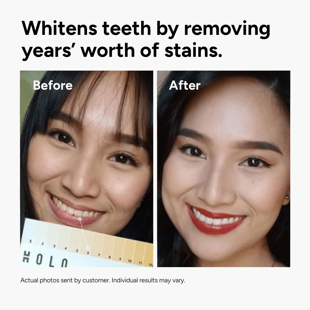 Holo Teeth Whitening Kit