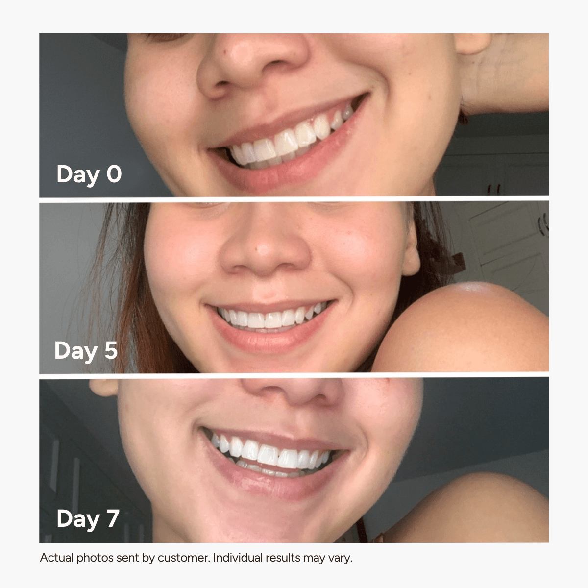 Holo Teeth Whitening Kit