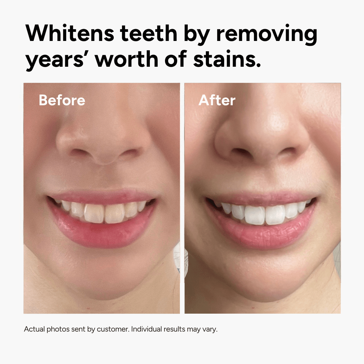 Holo Teeth Whitening Strips v2.1
